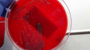 Throat swab on blood agar showing Steptoccus pyogens pin point beta hemolytic colony
