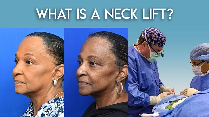 What is a Neck Lift?