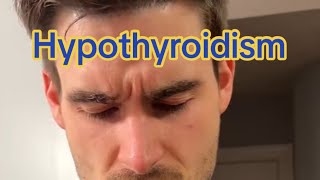 Hypothyroidism by Dr. Bozelka, ER Veterinarian 589 views 3 weeks ago 1 minute, 27 seconds