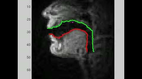Estimated upper and lower airway-tissue boundaries in the vocal tract