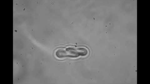 Measurements of the Disaggregation Forces between Two Erythrocytes using Optical Tweezers