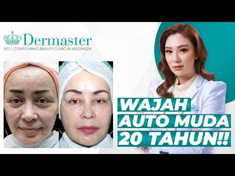 PERAWATAN BENANG APTOS TERBAIK DI DUNIA | Meet The #BeautyExpert : Episode 22