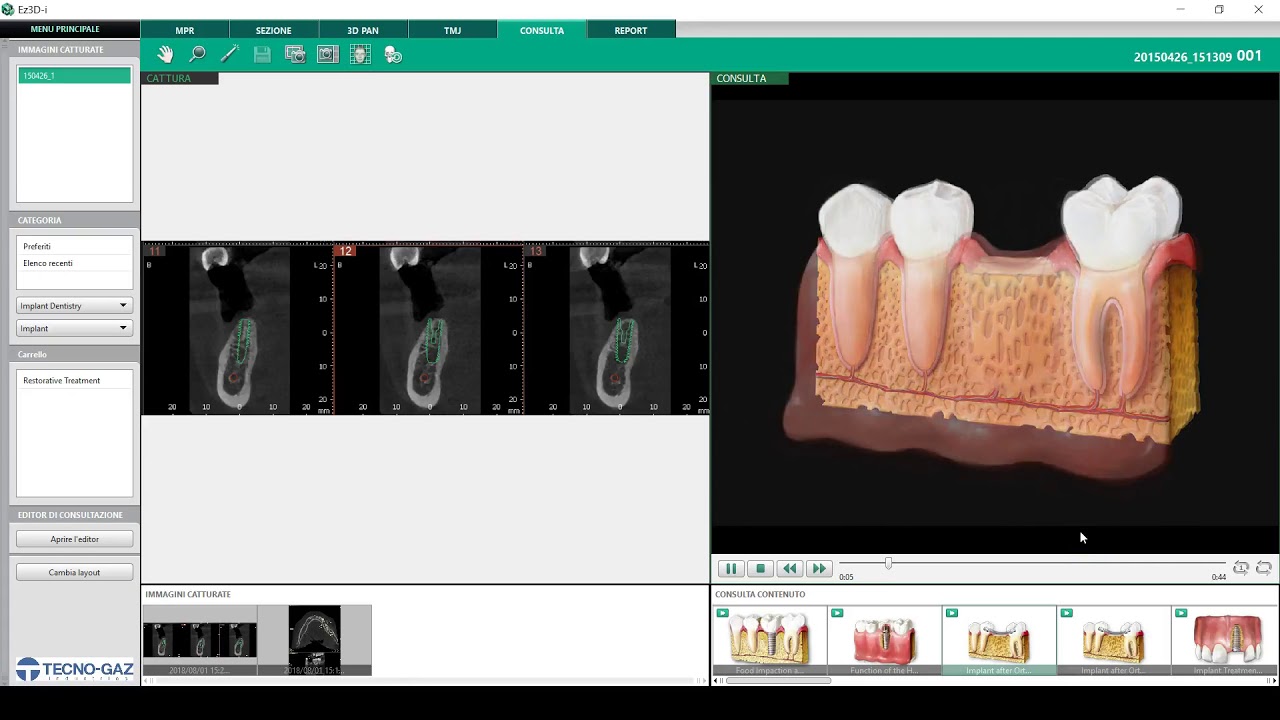 Software Ez3D-i : Ez-Codi