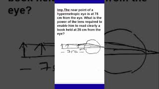 The Near Point | Hypermetropic Eye at 75 cm | Power of the Lens? | A Book at 25 cm from the eye