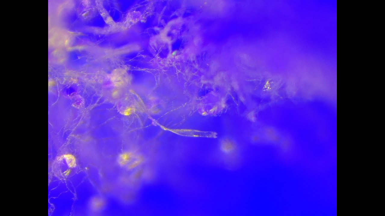 Tweed Strain Penelope Ch. Nr. PEN 8172F482 / Gespinste / Mikroskop 10-160X