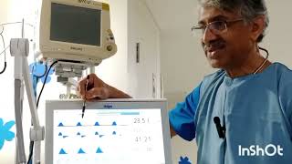 Pulmonary graphics  - a graph to Life