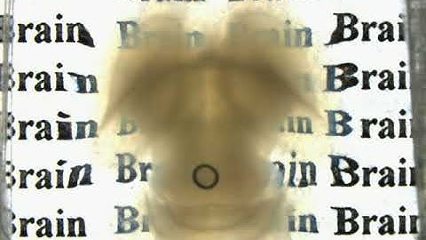 Mouse brain clearing in RapiClear 1 55