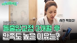 교정치료 전 가장 중요한 것은?돌출입교정 3개월 후 만족도가 높은 이유는 이것 덕분!