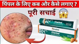 Clarina Anti Acne Cream Clarina Cream Ke Fayde Pimple Hatane Ka Tarika Pimple Cream