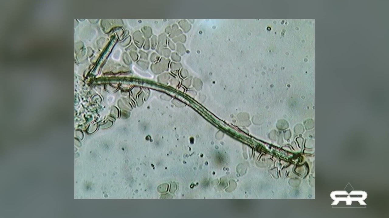 Heavy Metals / Nanotech in our blood? 