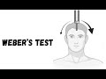 Weber’s Test | Clinical Examination | Ent