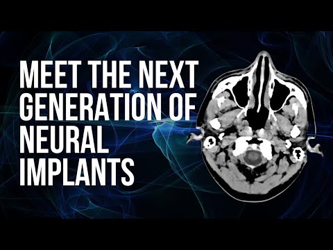 New Neural Implants Allow Deeper Exploration of the Brain