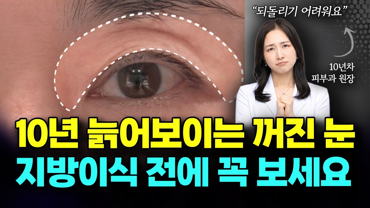 4050 꺼진 눈 살리는 초간단 해결법, 지방이식 vs 필러 vs 콜라겐 주사, 피부과 원장이 꺼진눈필러를 고른 이유 (feat. 다크서클)