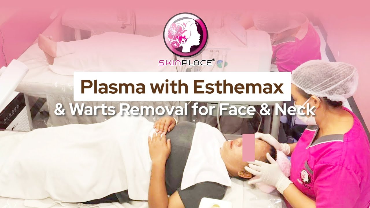 Skin Place Plasma with Esthemax & Warts Removal for Face & Neck 
