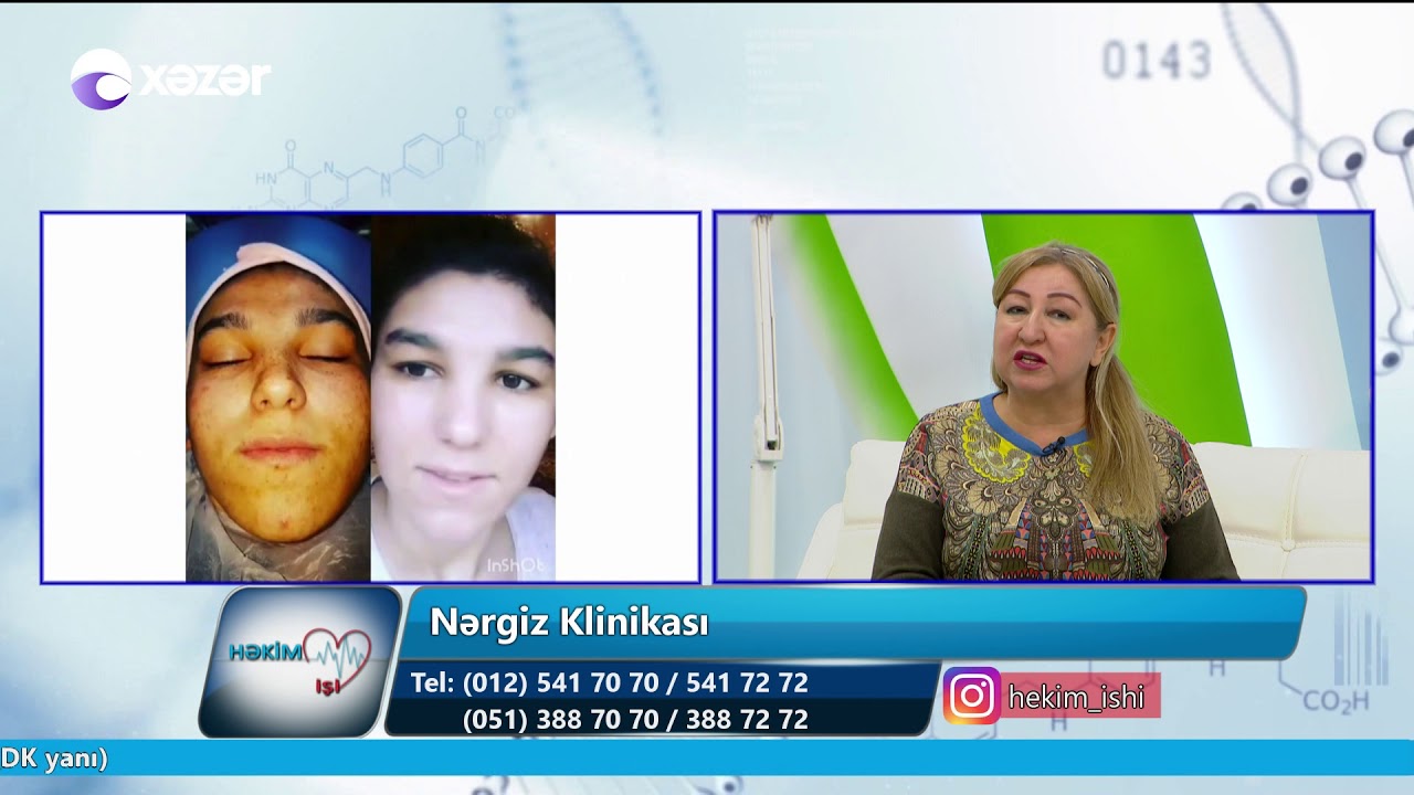 Mezoterapiya, dəri xəstəlikləri - Həkim İşi 19.04.2019