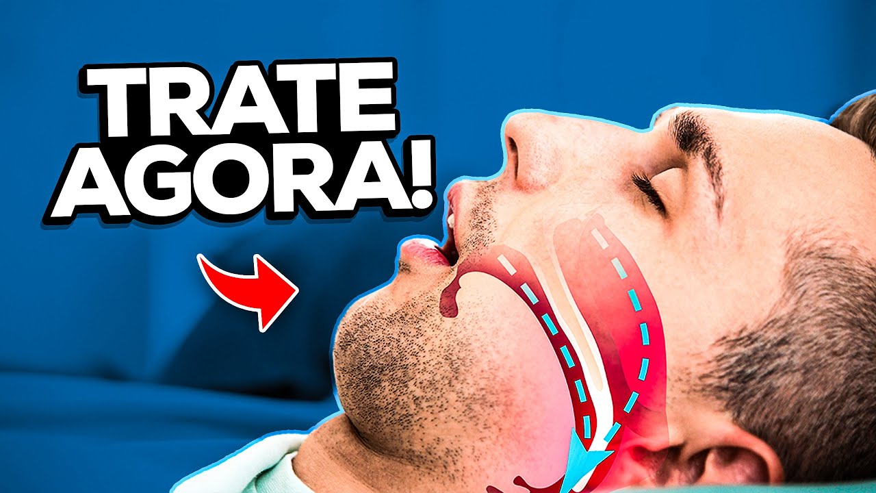 Quais São as Opções de Tratamento Clínico da Apneia Obstrutiva mal de alzheimer é hereditário