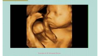 Baby s Close-Up Ultrasound Theater Slideshow