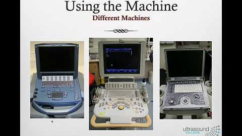 Performing an Ultrasound