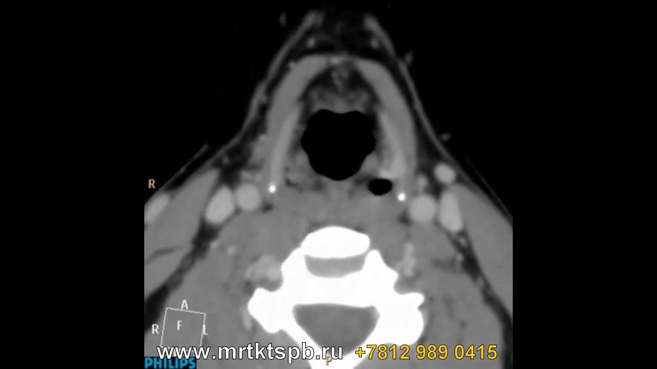 кт гортани москва