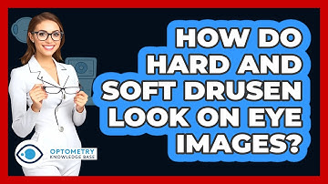 How Do Hard And Soft Drusen Look On Eye Images? - Optometry Knowledge Base
