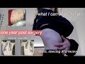 ONE YEAR POST SCOLIOSIS SURGERY UPDATE!