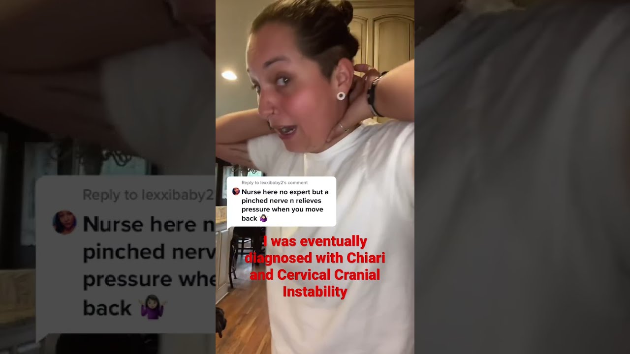 Weird Face Trick Chiari And Cervical Cranial Instability 
