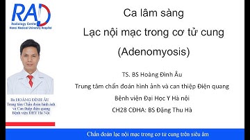 Chẩn đoán lạc nội mạc trong cơ tử cung trên siêu âm