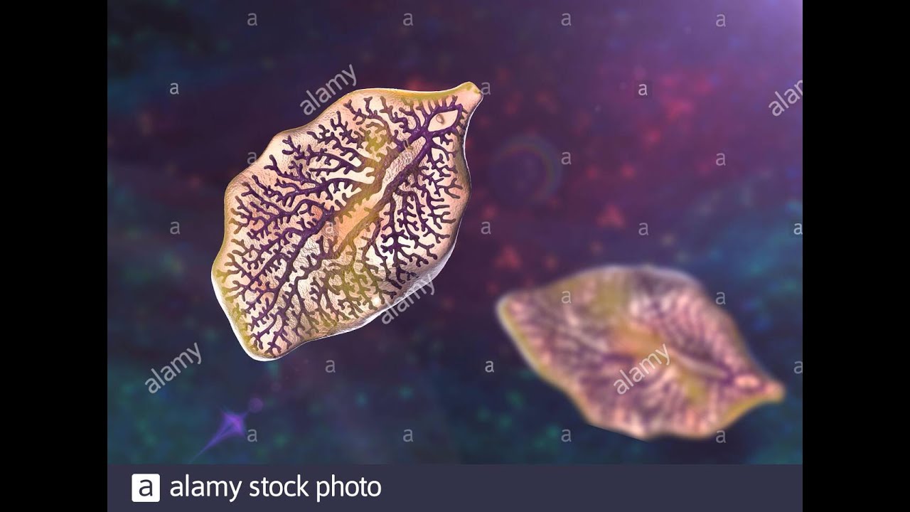 distomatose /douves 3eme année médecine résumé du cours que l'essentiel