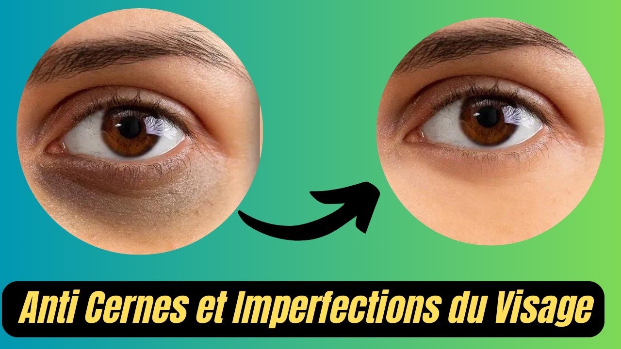 Comment Traiter efficacement et Naturellement les Cernes et ...