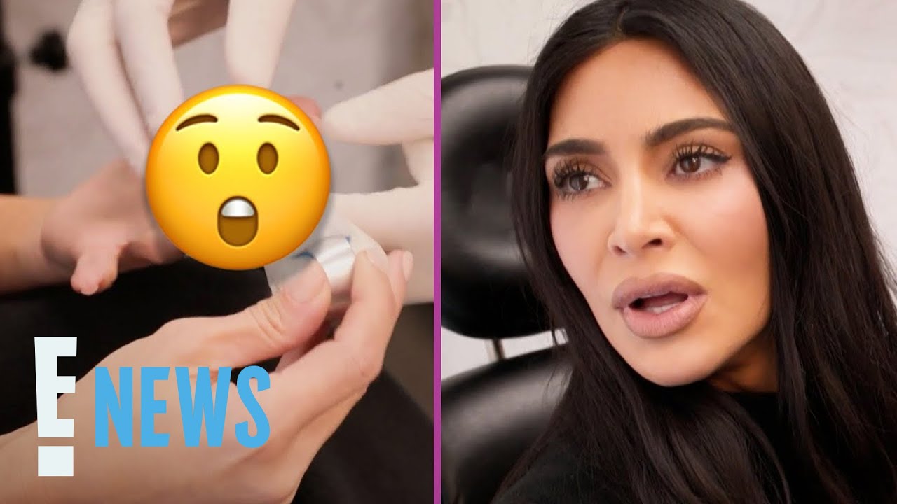 Kim Kardashian’s Shocking Hand Injury Said to Be “Worse Than Childbirth”