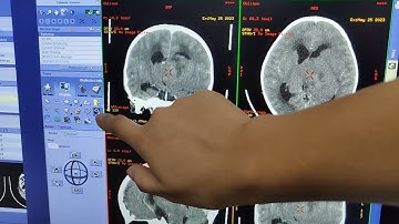 CT GE, loop feature to straighten images, don