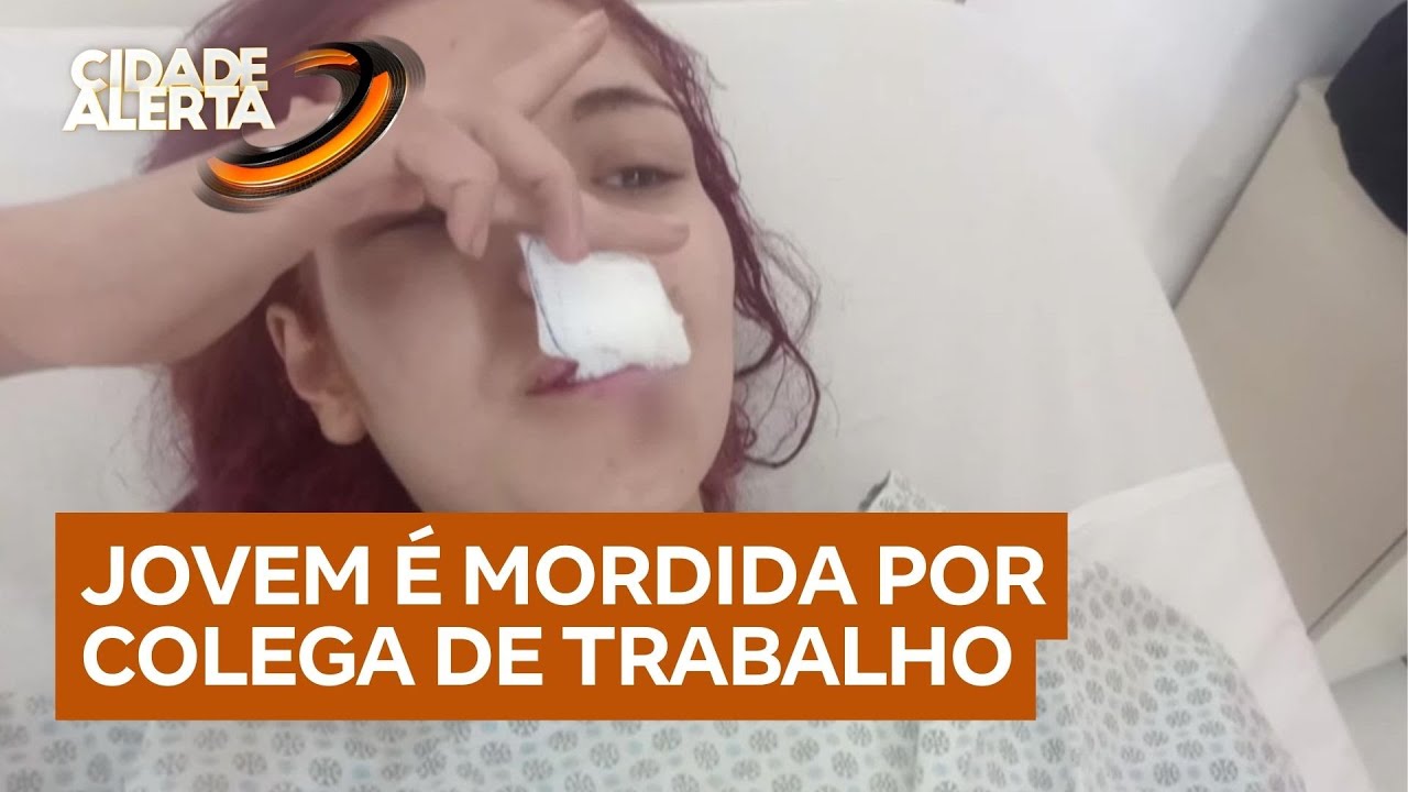 Jovem perde parte do lábio após ser mordida por colega de trabalho em Osasco, na Grande São Paulo