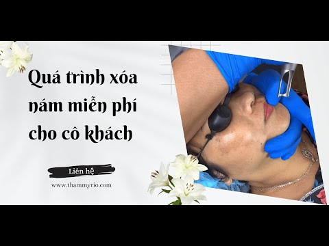 Điều trị nám, điều trị tàn nhang lâu năm hiệu quả, trẻ hoá làn da 6 YouTube player