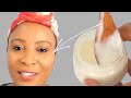 How To Boost Natural Collagen In Your Face And Neck, | Laugh Lines, Frown Lines +Jawlin e