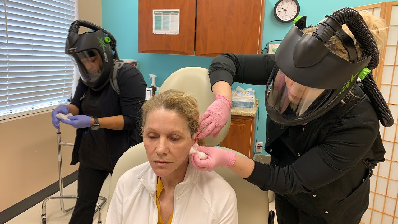 1 day after local anesthesia facelift Graphic Viewer discretion