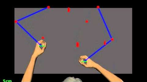 KINARM Movies Cardiac arrest