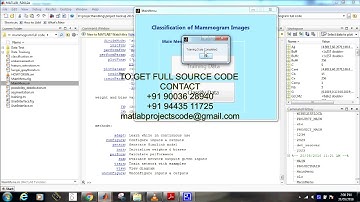 Matlab code for One class classification of mammograms using trace transform functionals
