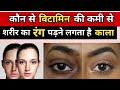 पिगमेंटेशन को जड़ से खत्म करने के उपाए Get Rid of Hyperpigmentation Naturally | Clear & Glowing Skin