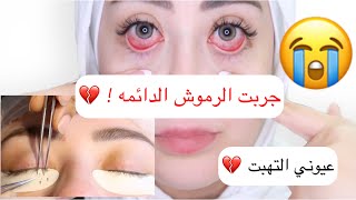 تجربتي مع الرموش الدائمه 😭 شوفوا شو صار معي 💔|| شهد ناصر 🌸