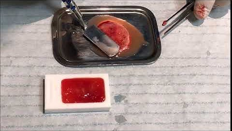 Técnica Sticky Bone