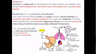 For more information, log on to-http://shomusbiology.weebly.com/this
helicobactor pylori pathogenesis lecture explains the diagnosis of
i...