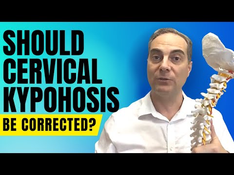 Video: Dapatkah chiropractor membantu lordosis?