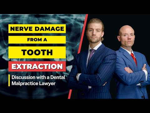 Can Tooth Extraction Cause Nerve Damage? | Discussion with a Florida Dental Malpractice Attorney
