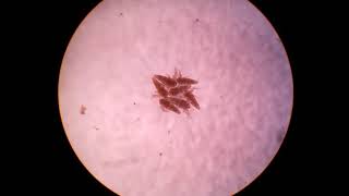 Artemia under microscope