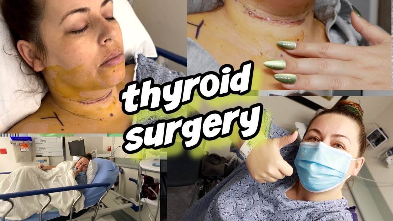 Thyroid Surgery Vlog