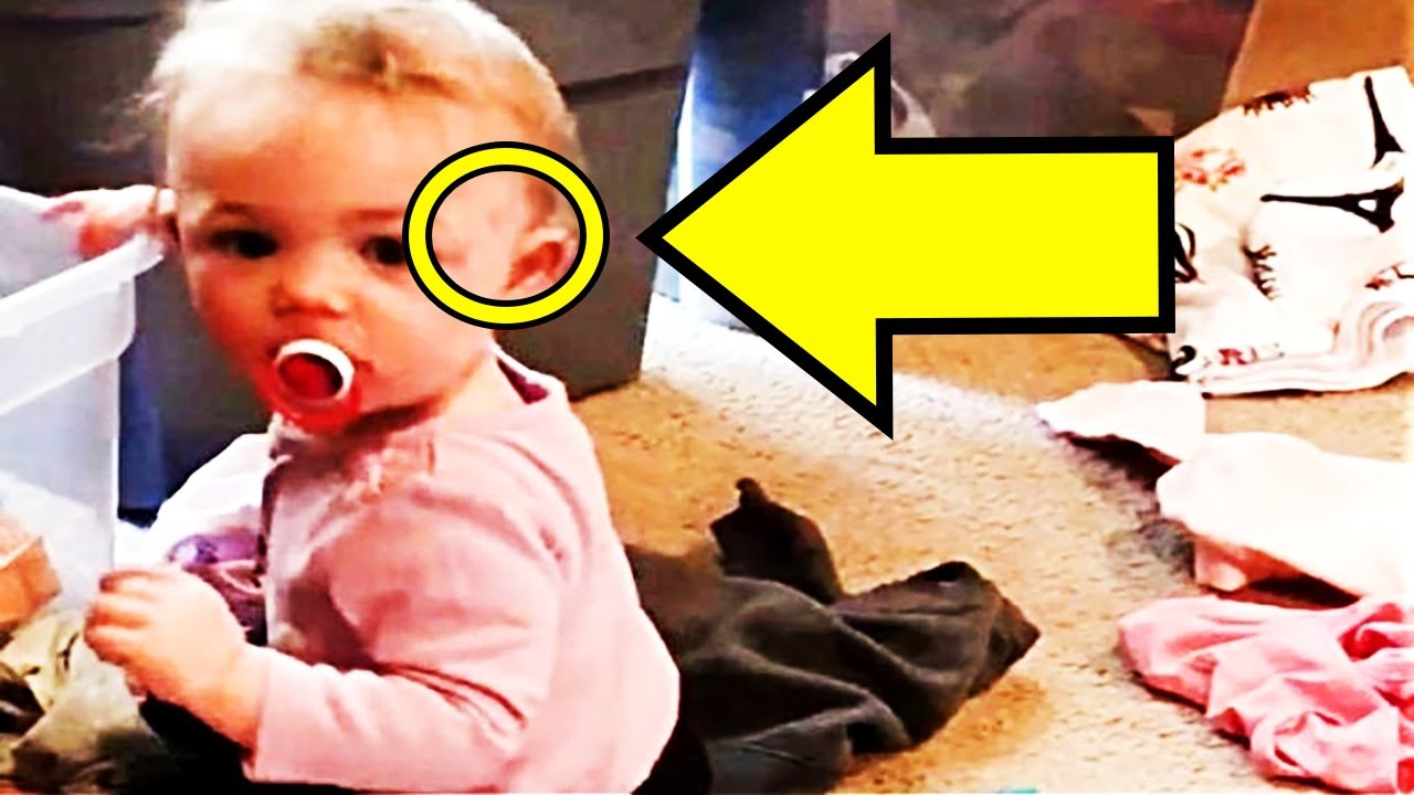 After Their Baby Woke Up With Scratches, These Parents Discovered