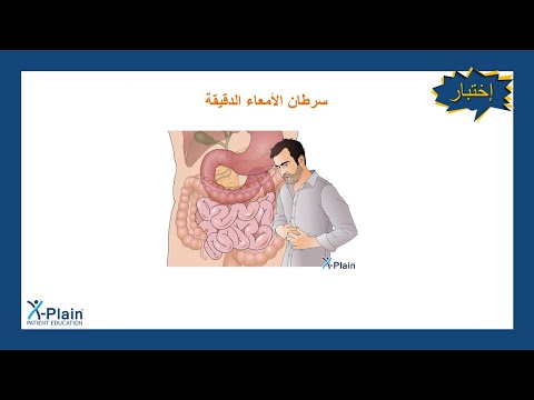 سرطان الأمعاء الدقيقة اختبار