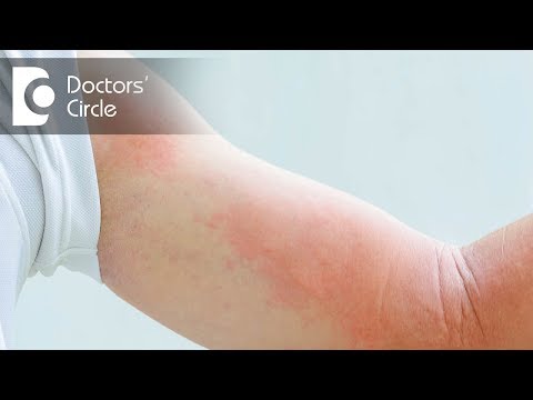 What causes Cold