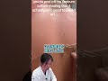 日焼けの後の皮膚をぺりぺり剥くのは医学的に大丈夫? たかし先生が動画を見ながら解説!