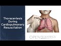 "Thoracentesis During Cardiopulmonary Resuscitation" by Samuel Rice-Townsend for OPENPediatrics